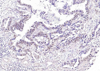 THRB Mouse Monoclonal Antibody