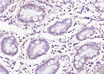 THRB Mouse Monoclonal Antibody