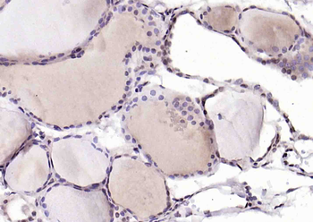 THRB Mouse Monoclonal Antibody