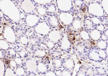 THRB Mouse Monoclonal Antibody
