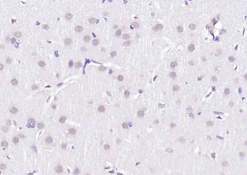 THRB Mouse Monoclonal Antibody