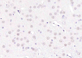 THRB Mouse Monoclonal Antibody