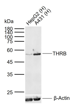 THRB Mouse Monoclonal Antibody