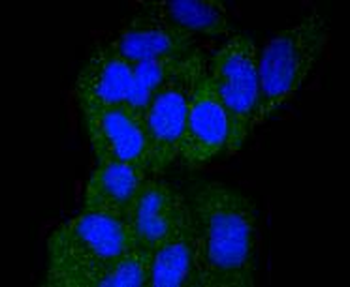 GART Recombinant Rabbit Monoclonal Antibody
