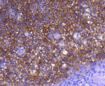 GART Recombinant Rabbit Monoclonal Antibody
