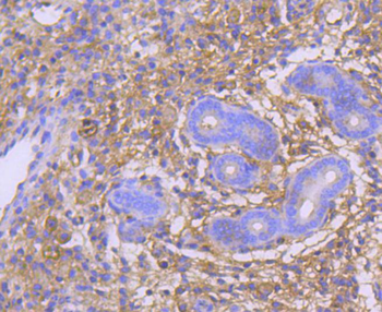 GART Recombinant Rabbit Monoclonal Antibody