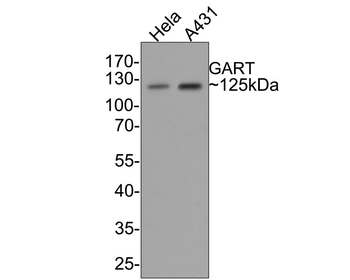 GART Recombinant Rabbit Monoclonal Antibody