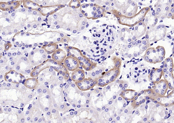 SPARC Rabbit Polyclonal Antibody