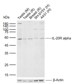 IL-20R alpha Rabbit Polyclonal Antibody