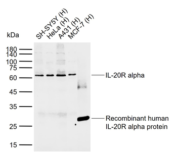 IL-20R alpha Rabbit Polyclonal Antibody