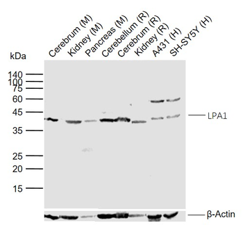 LPA1 Rabbit Polyclonal Antibody