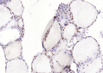 PAX8 Recombinant Rabbit Monoclonal Antibody