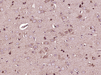 STIM1 Rabbit Polyclonal Antibody