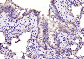 NFATC4 Rabbit Polyclonal Antibody