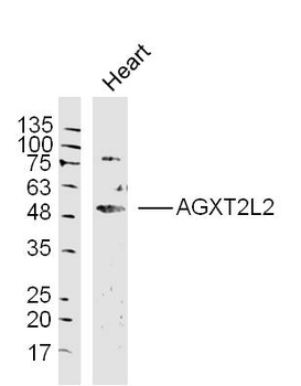 AGXT2L2 Rabbit Polyclonal Antibody