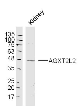 AGXT2L2 Rabbit Polyclonal Antibody