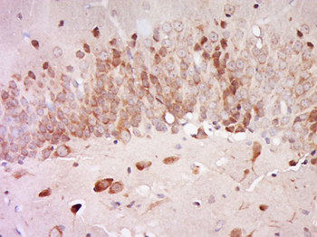 AGXT2L2 Rabbit Polyclonal Antibody