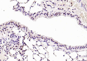 RNA polymerase II Rabbit Polyclonal Antibody
