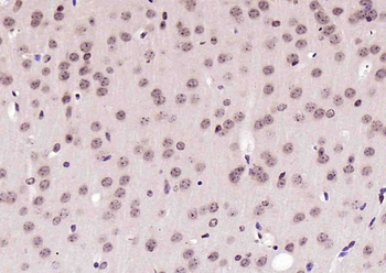 RNA polymerase II Rabbit Polyclonal Antibody