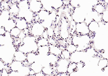 RNA polymerase II Rabbit Polyclonal Antibody