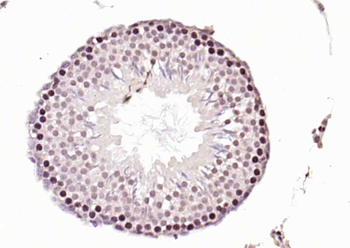 RNA polymerase II Rabbit Polyclonal Antibody