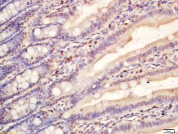 RNA polymerase II Rabbit Polyclonal Antibody