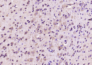 ETFA Rabbit Polyclonal Antibody
