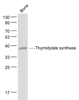 TYMS Rabbit Polyclonal Antibody