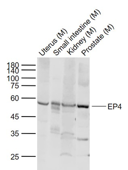 EP4 Rabbit Polyclonal Antibody