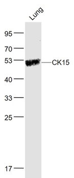 CK15 Rabbit Polyclonal Antibody