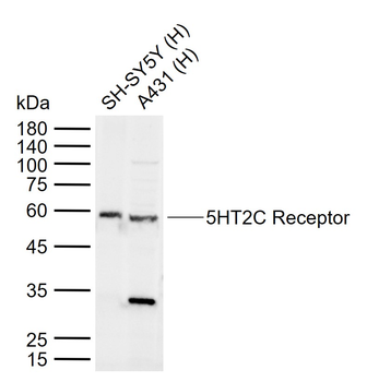 5HT2C Receptor Rabbit Polyclonal Antibody