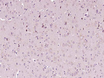 5HT4 Receptor Rabbit Polyclonal Antibody