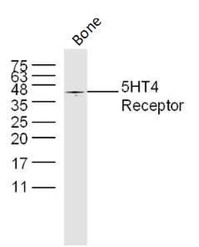 5HT4 Receptor Rabbit Polyclonal Antibody