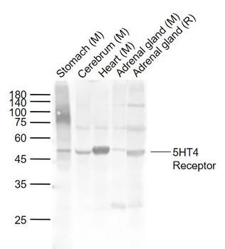5HT4 Receptor Rabbit Polyclonal Antibody