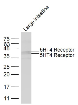 5HT4 Receptor Rabbit Polyclonal Antibody