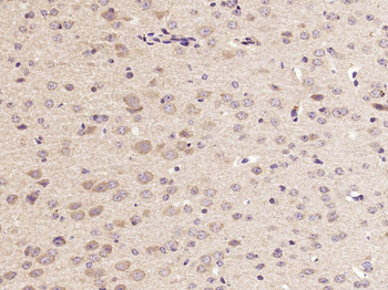 ACHE Rabbit Polyclonal Antibody