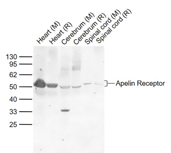 Apelin Receptor Rabbit Polyclonal Antibody