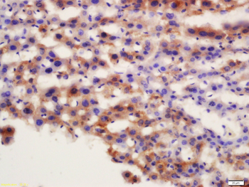 ATG7/APG7 Rabbit Polyclonal Antibody