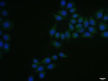 Axin1 Rabbit Polyclonal Antibody