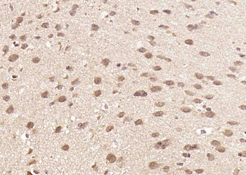 Axin1 Rabbit Polyclonal Antibody