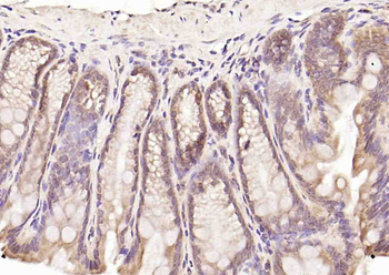 Axin1 Rabbit Polyclonal Antibody