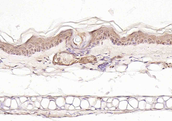 Axin1 Rabbit Polyclonal Antibody