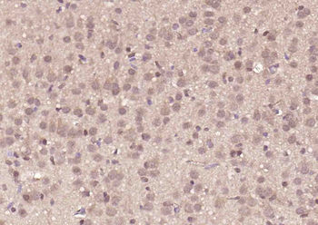 Axin1 Rabbit Polyclonal Antibody