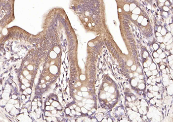 Axin1 Rabbit Polyclonal Antibody