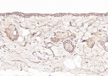 Axin1 Rabbit Polyclonal Antibody