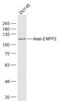 ENPP2 Rabbit Polyclonal Antibody