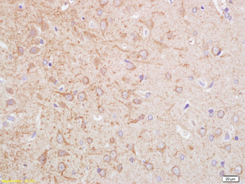 BCHE (1E8) Mouse Monoclonal Antibody