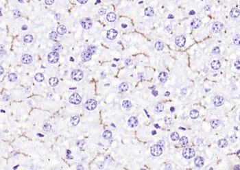 ABCB11 Rabbit Polyclonal Antibody
