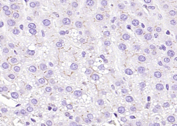 ABCB11 Rabbit Polyclonal Antibody