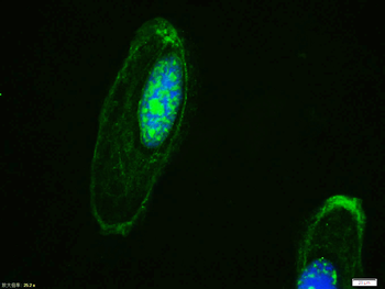 Phospho-beta catenin (Tyr142) Rabbit Polyclonal Antibody